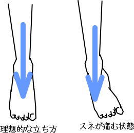 スネの痛み 藤沢で10年 女性の体に特化した痛みをとる整体 まごのて庵